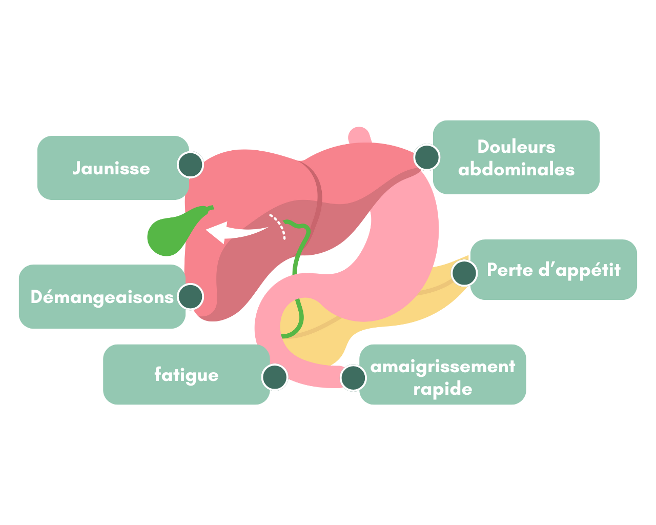 Symptômes avant-coureurs cholangiocarcinome