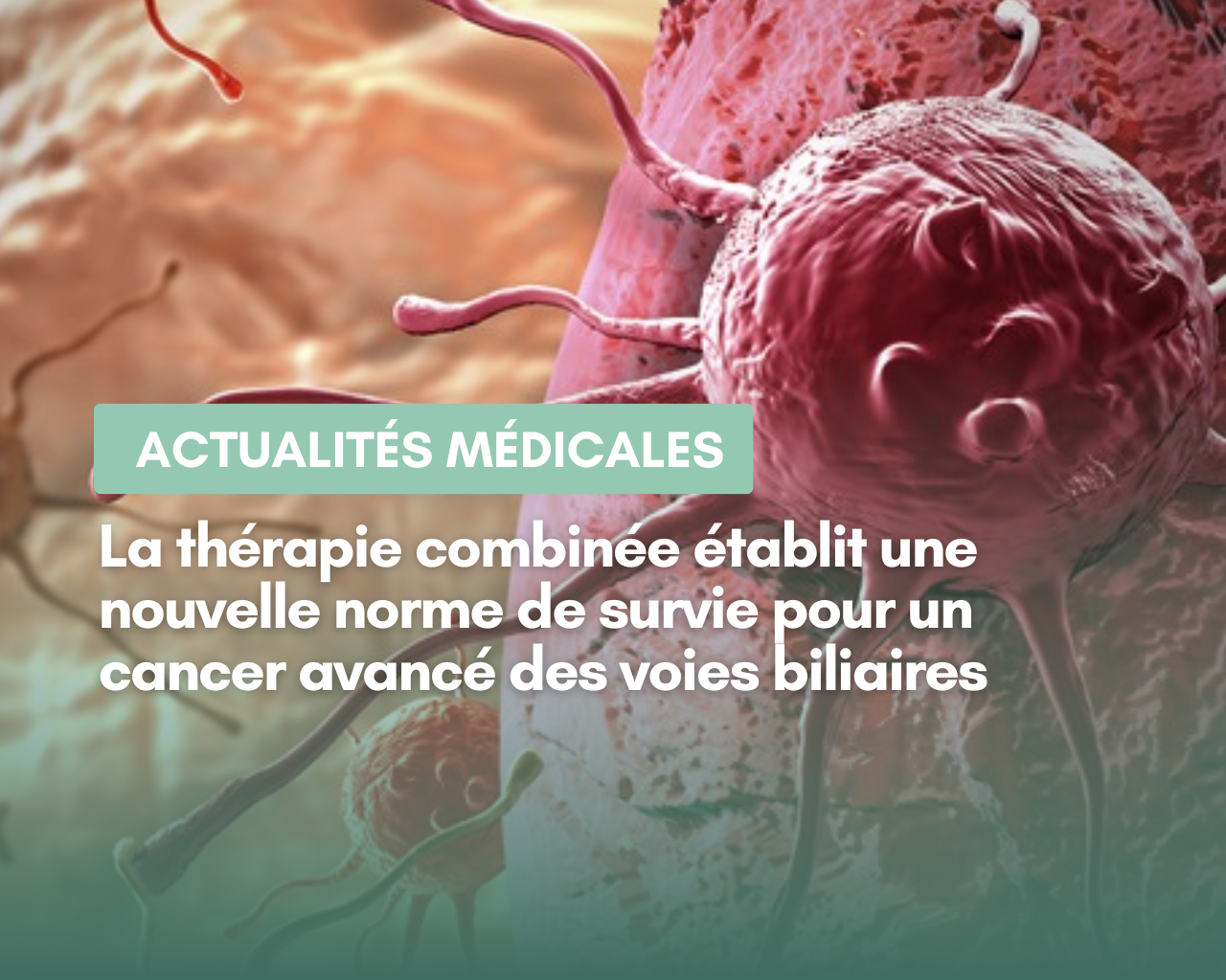 Thérapie Combinée Cancer Des Voies Biliaires